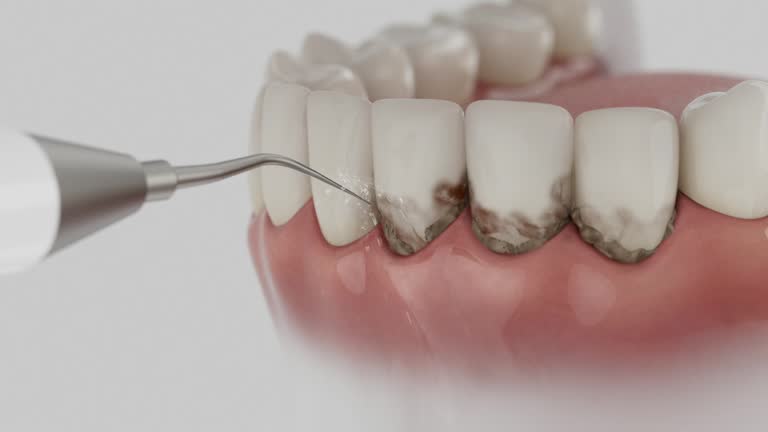 Trusted Teeth Cleaning And Checkup service in China Spring, TX - Dentist Open Now
